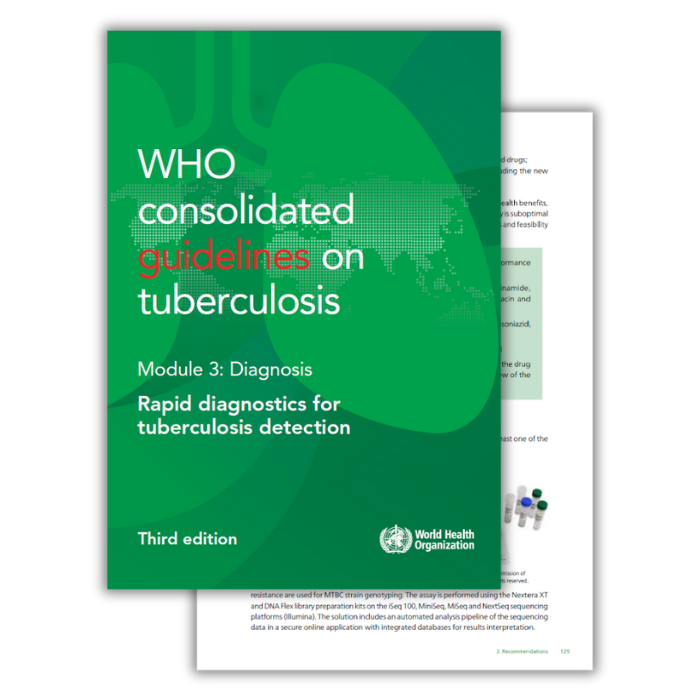 WHO consolidated guidelines on tuberculosis